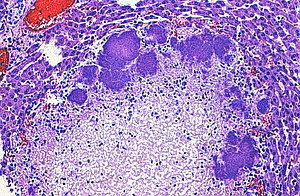 Histologic picture of yersiniosis in the liver of a common marmoset, H&E staining. Photo: DPZ